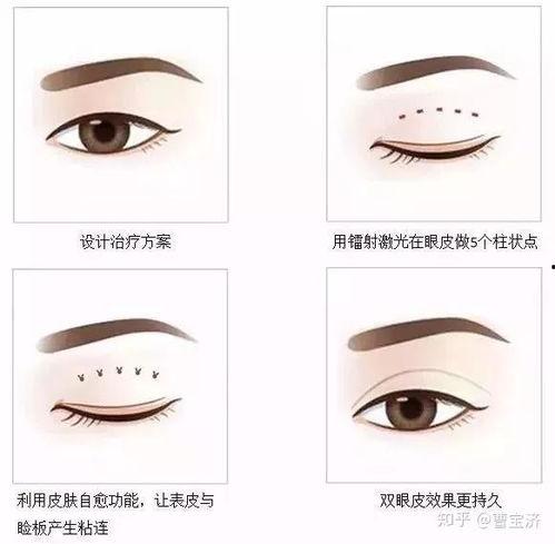 定位双眼皮视频,揭秘完美双眼皮的秘密
